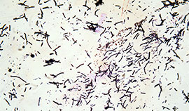 唾液の中の浮遊細菌のチェック